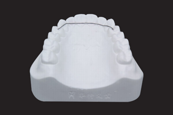 固定保持器(麻花絲)(舌側(cè)保持器)